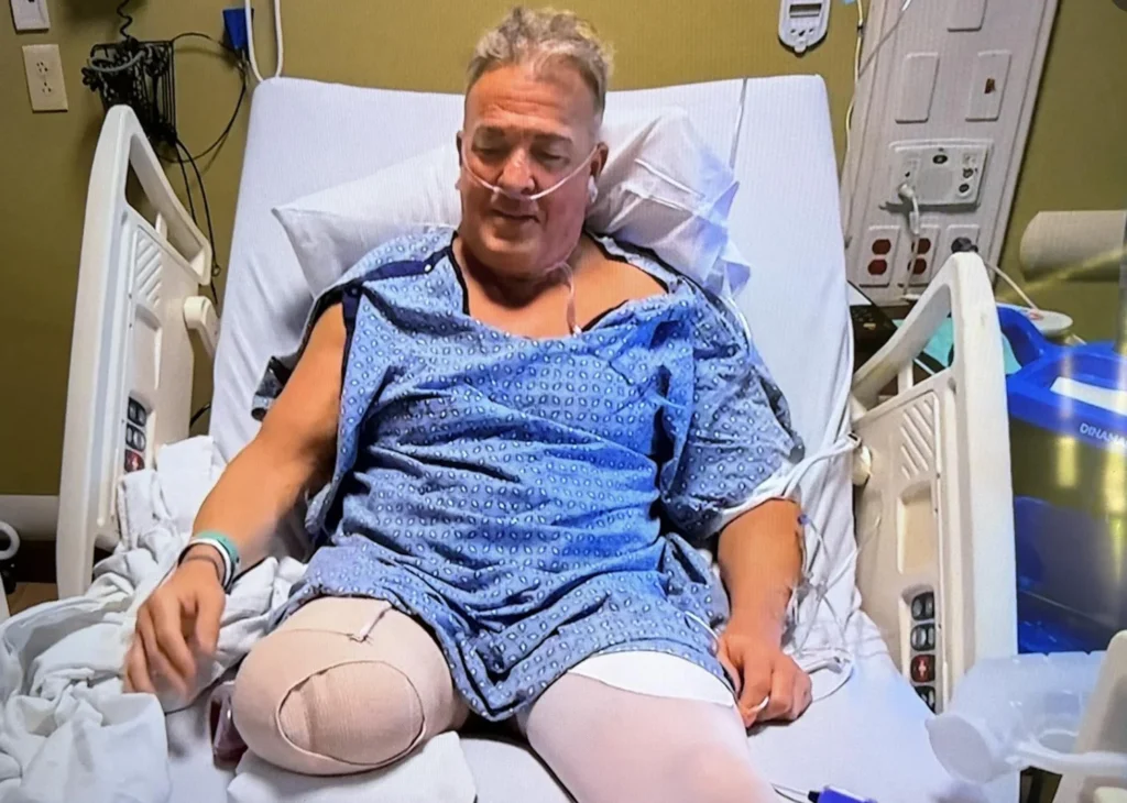 Buff Bagwell, ex luchador de WWE, pierde una pierna: ¿qué le pasó?