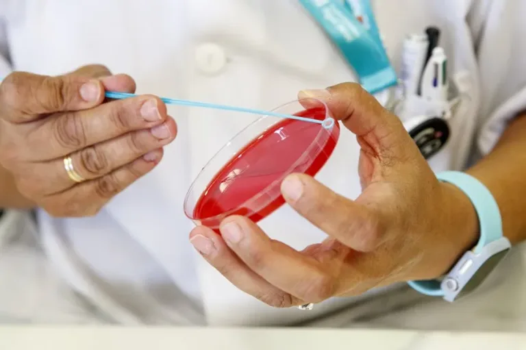 ¿Por qué EE.UU. enfrenta el peor brote de sarampión en años?