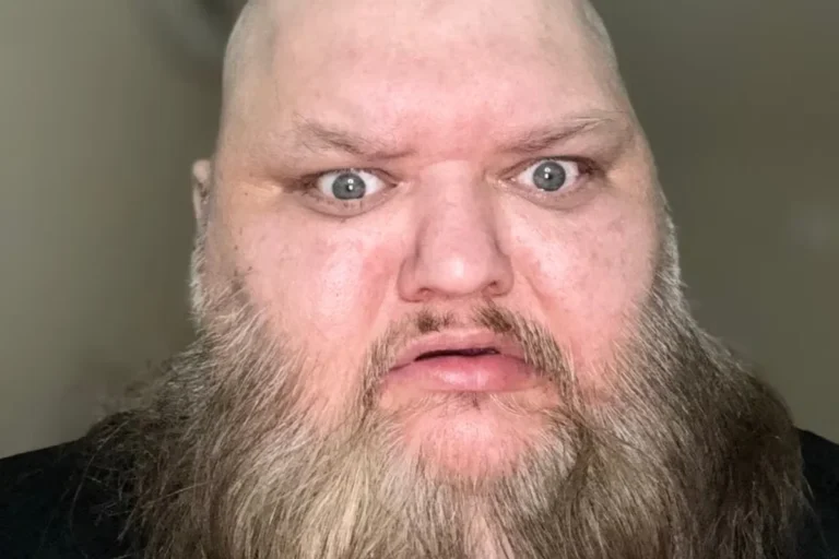 ¿De qué murió John Crawley?, el tiktoker conocido como KingBeardX