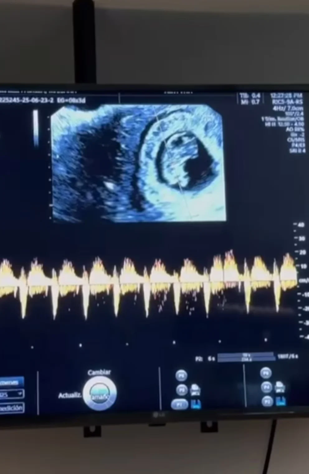 Vicente Fernández Jr. anuncia que será padre a los 62 años