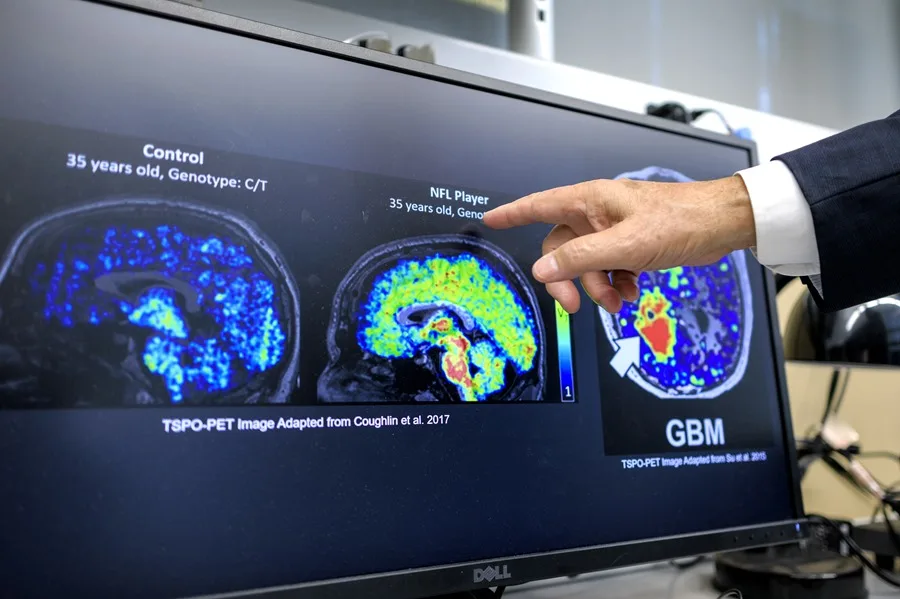 Científicos latinos en EE.UU. podrían cambiar la lucha contra el Alzheimer