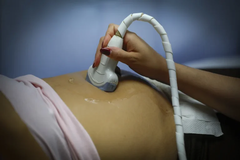 paracetamol en embarazo causa autismo