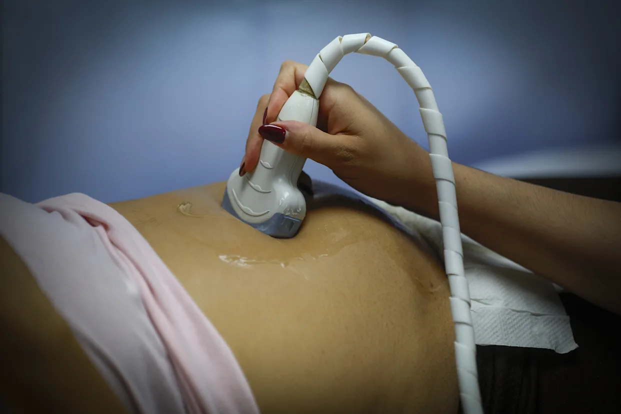 paracetamol en embarazo causa autismo