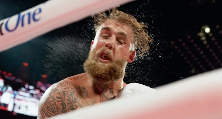 Jake Paul muestra su mandíbula rota tras pelea con Anthony Joshua