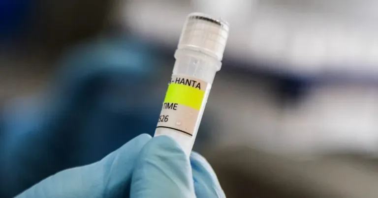 Hantavirus caso confirmado eeuu